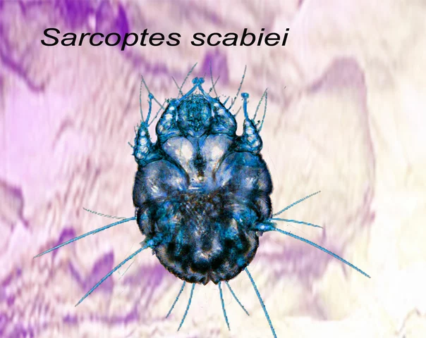 The potential long-term consequences of untreated Sarcoptes scabiei infestations