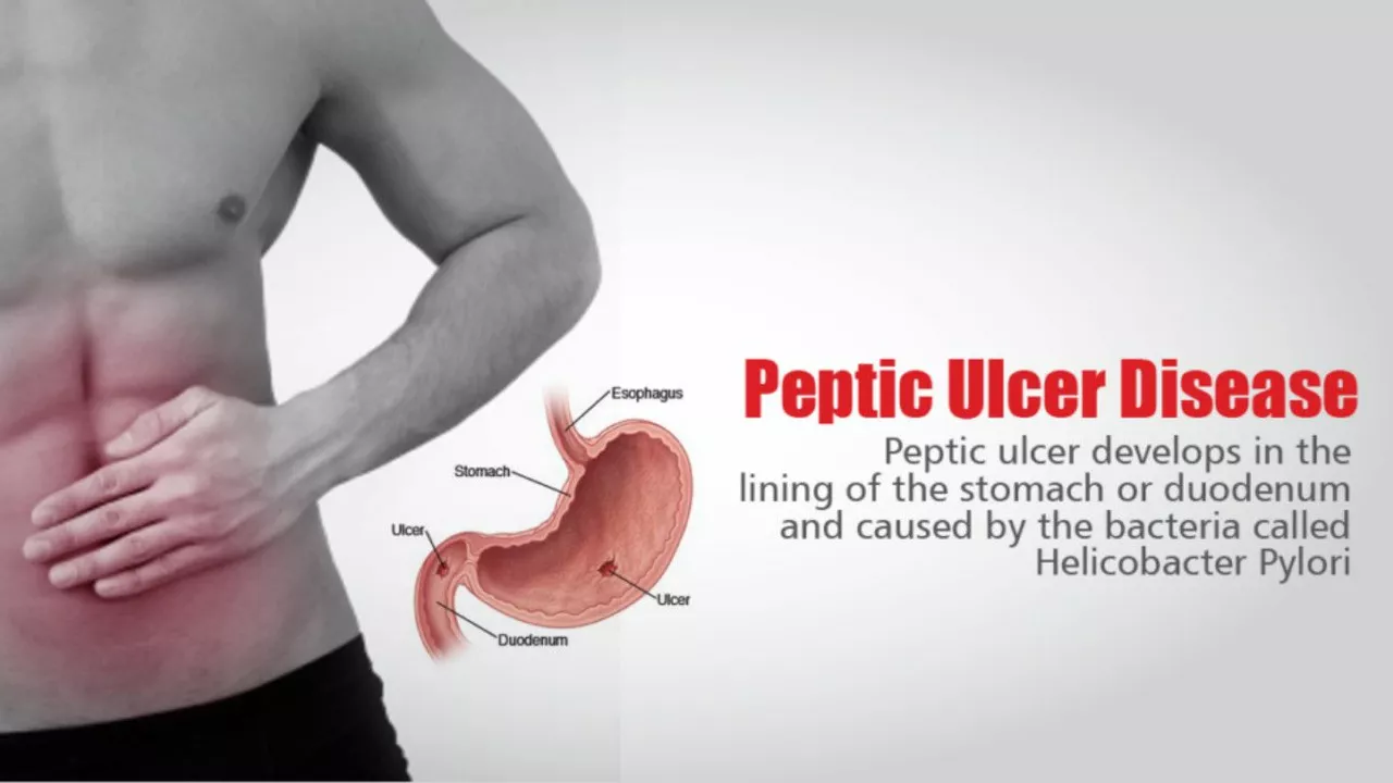 The role of gut bacteria in ulcer development and healing